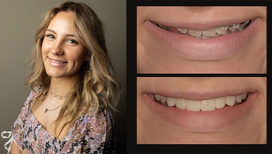 Dentist Arlington Texas | Dentist in Arlington