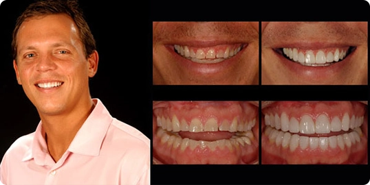 Dentist Arlington Texas | Dentist in Arlington