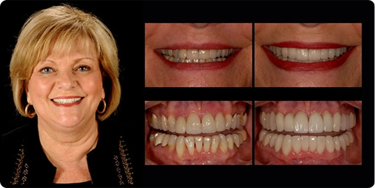 Dentist Arlington Texas | Dentist in Arlington