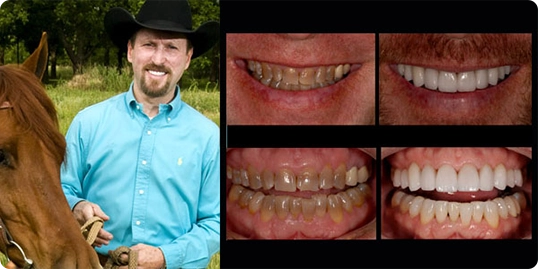 Dentist Arlington Texas | Dentist in Arlington