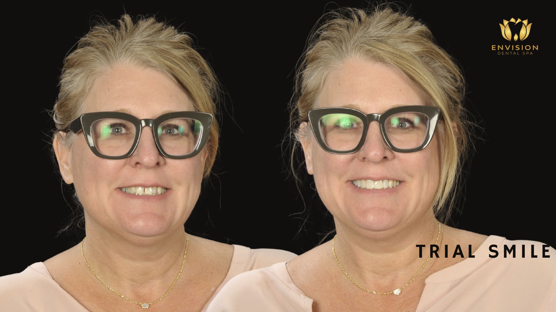 Dentist Arlington Texas | Dentist in Arlington