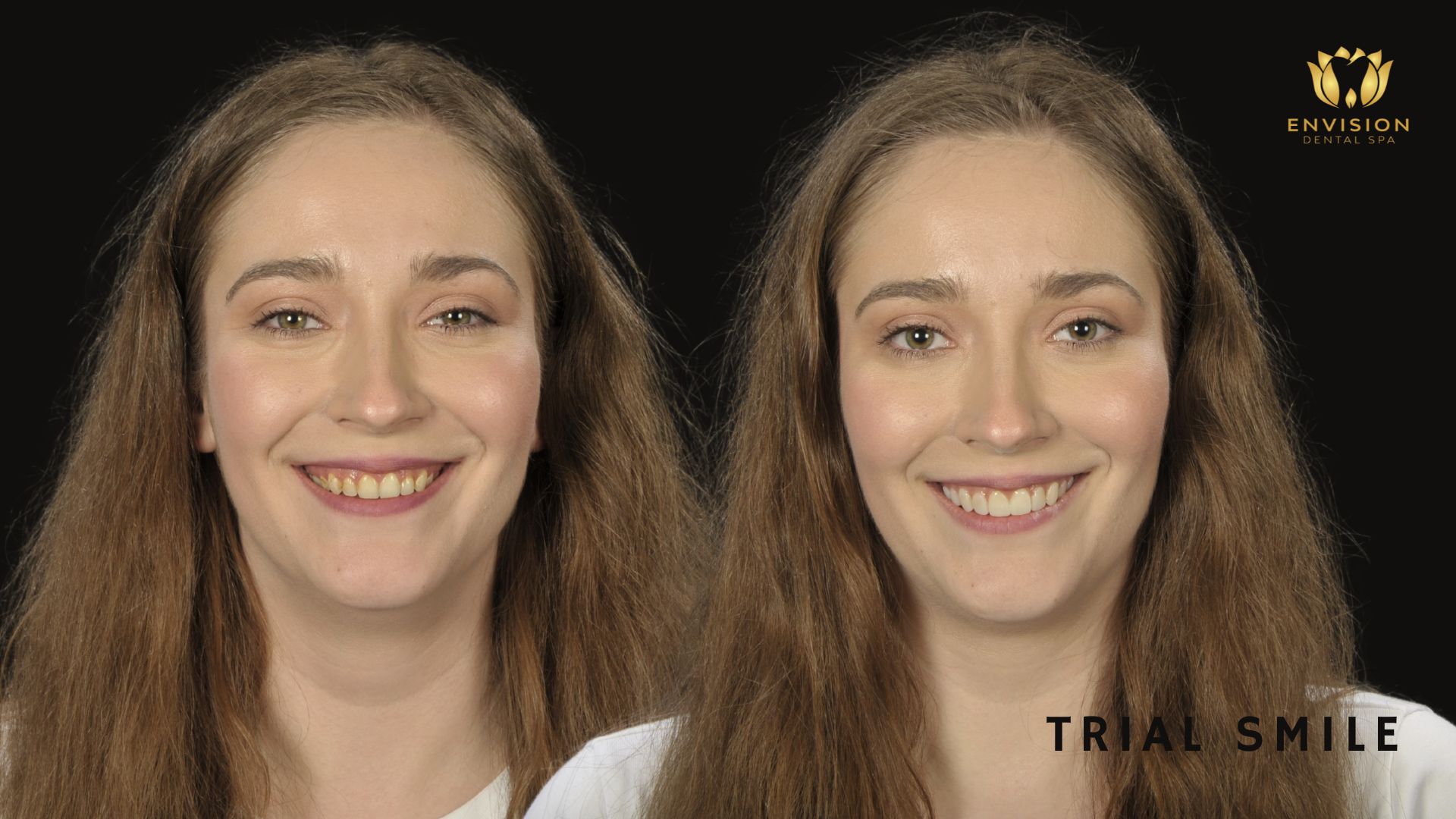 Dentist Arlington Texas | Dentist in Arlington