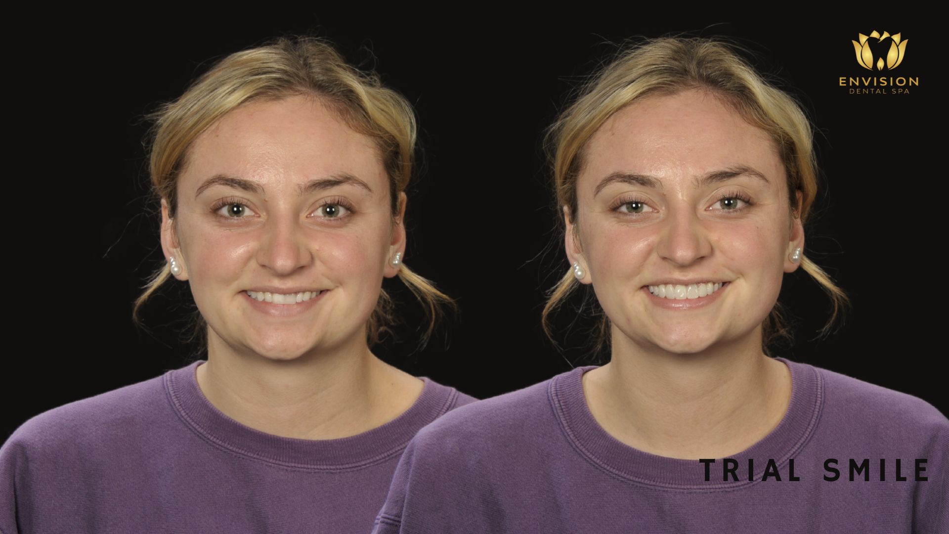 Dentist Arlington Texas | Dentist in Arlington