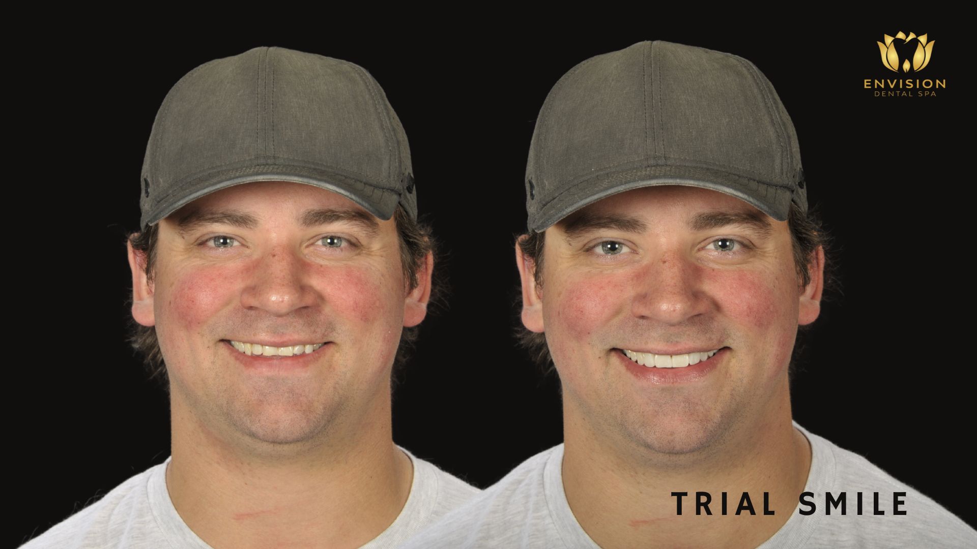 Dentist Arlington Texas | Dentist in Arlington