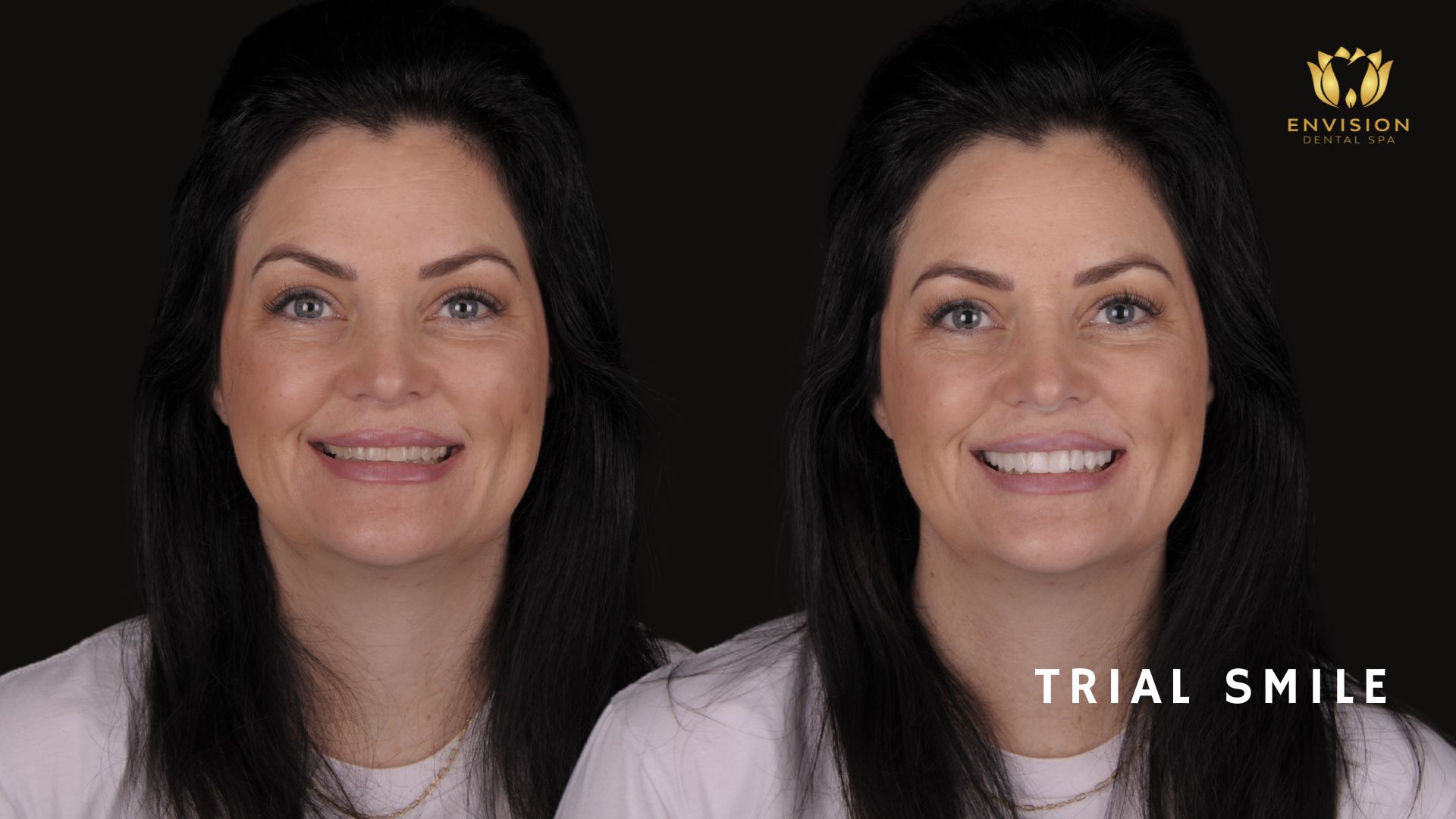 Dentist Arlington Texas | Dentist in Arlington