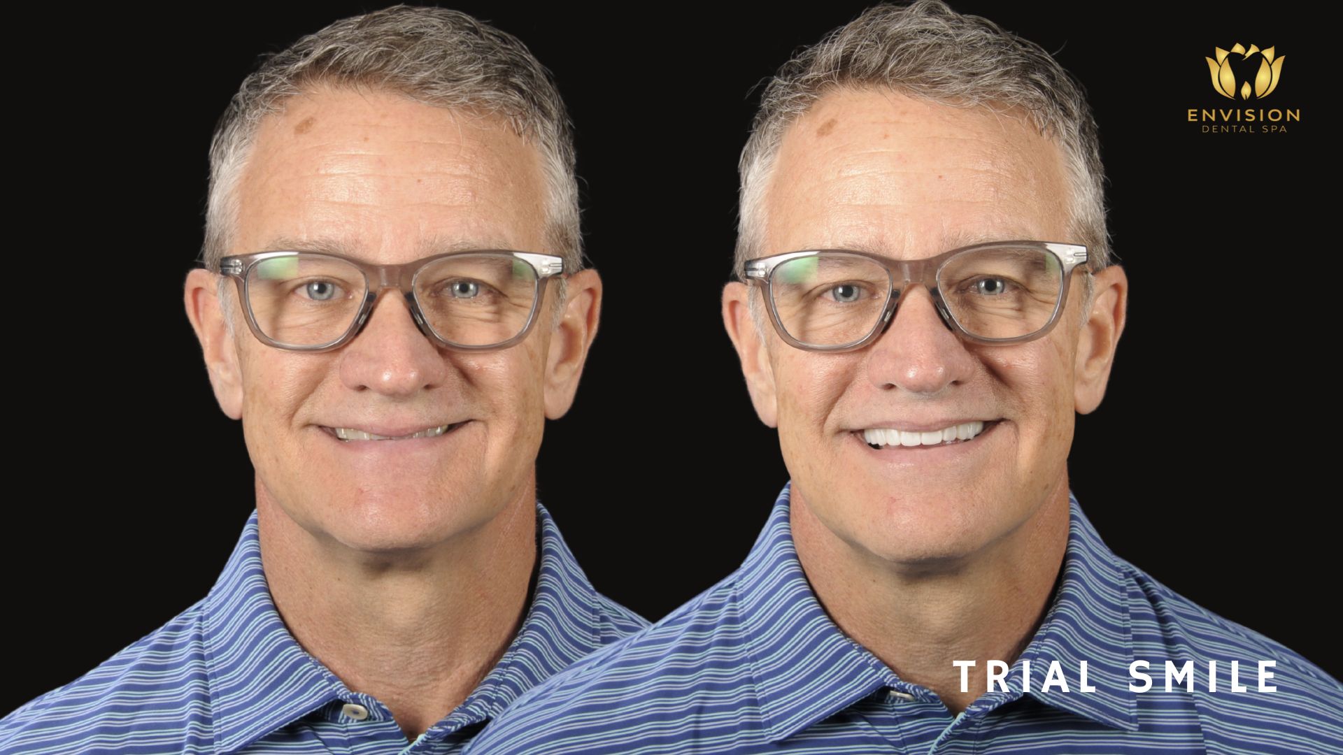 Dentist Arlington Texas | Dentist in Arlington