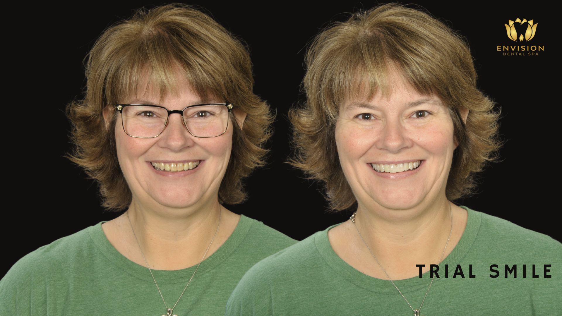 Dentist Arlington Texas | Dentist in Arlington