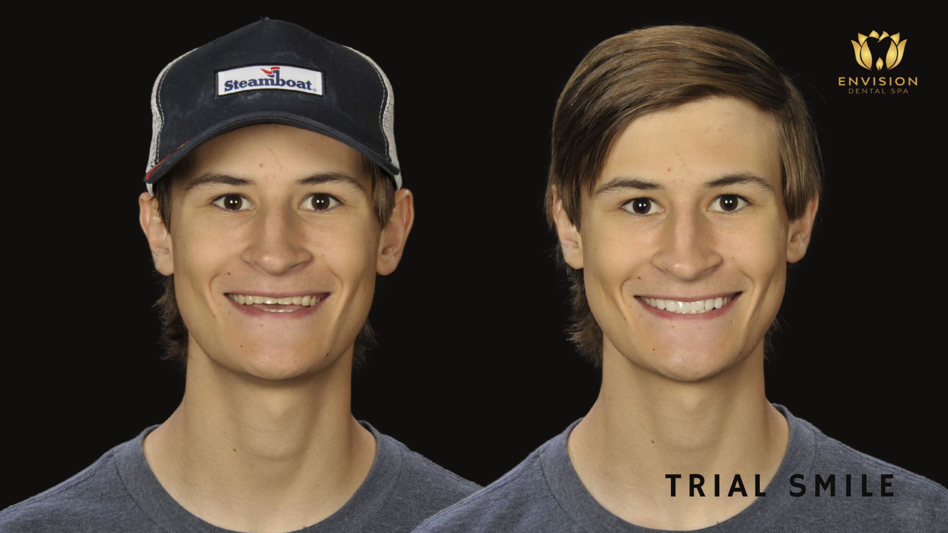 Dentist Arlington Texas | Dentist in Arlington