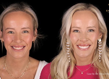 Cosmetic dentistry before and after