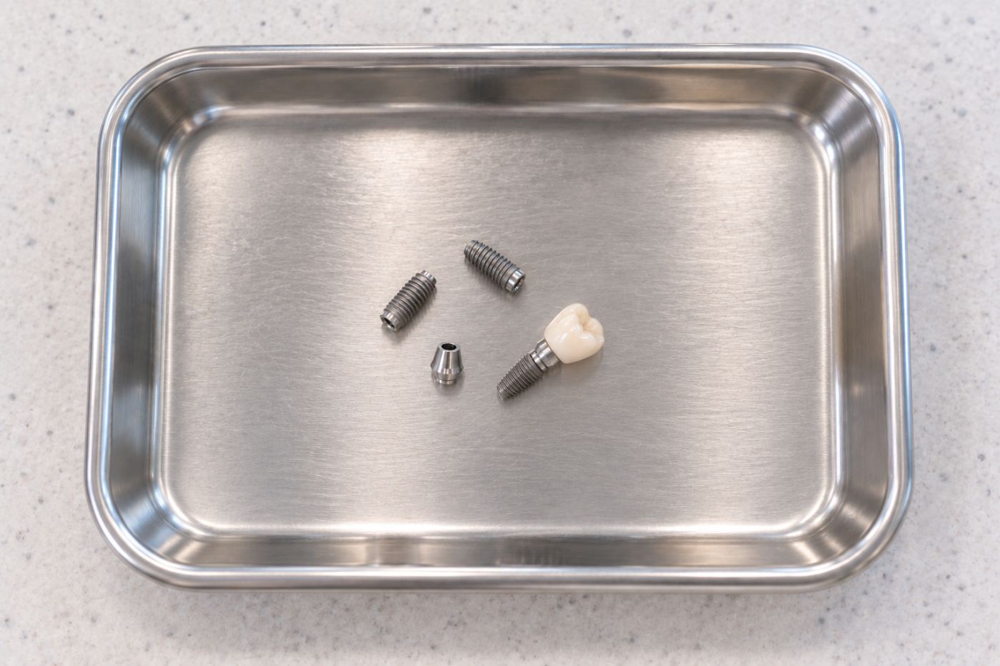 How Much Do Dental Implants Cost? (2026 Guide)