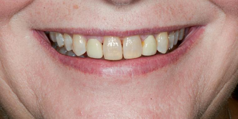 Case photo