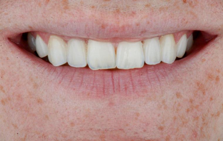 Case photo