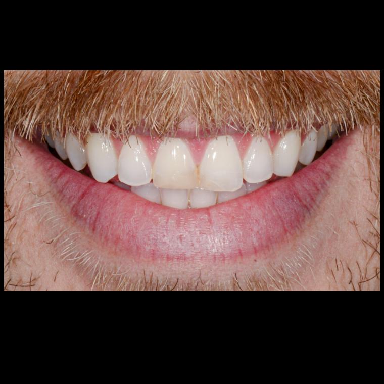 Case photo