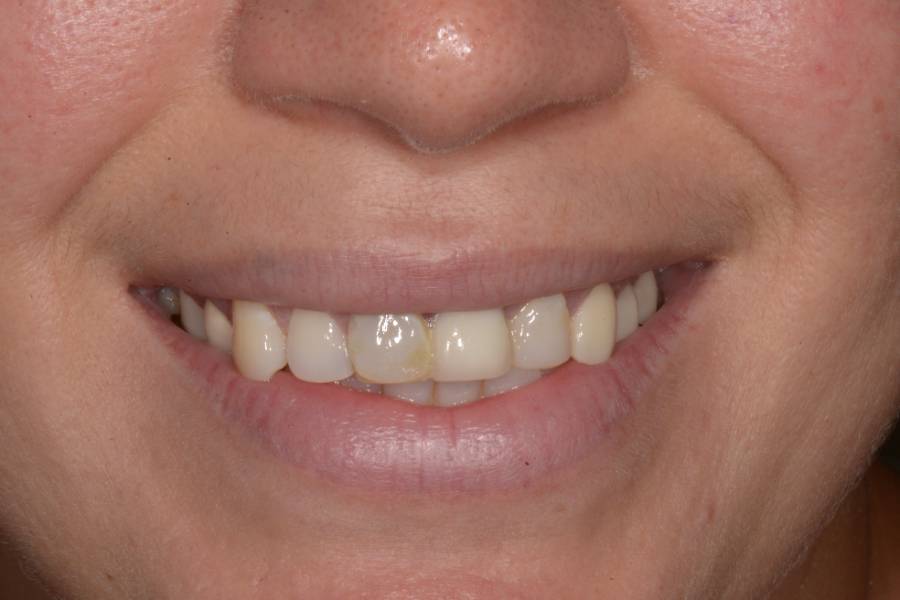 Case photo