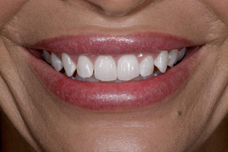 Case photo