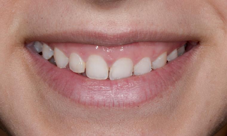 Case photo
