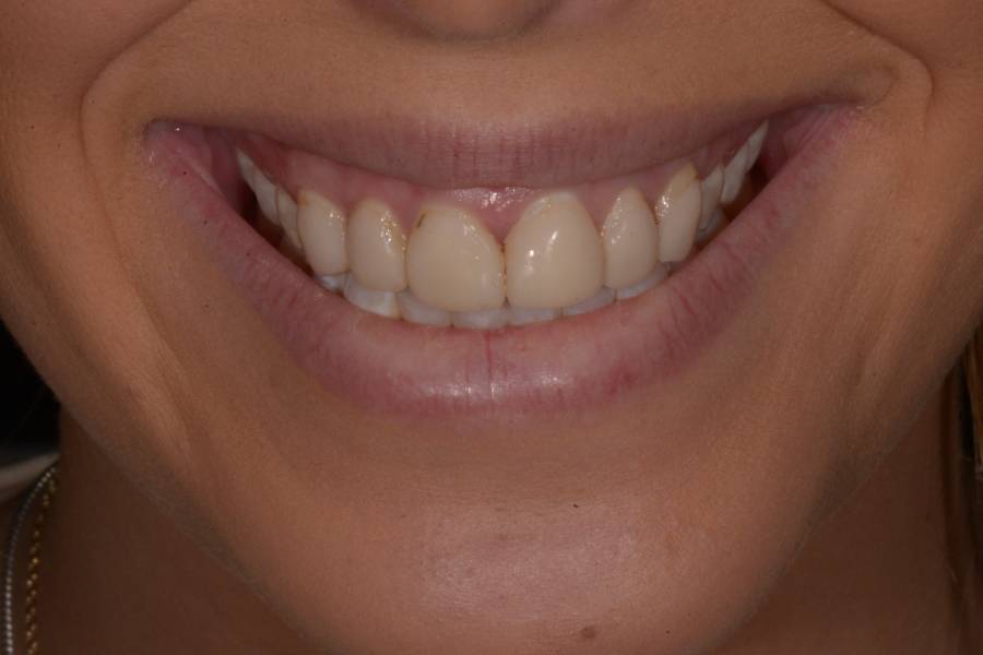 Case photo
