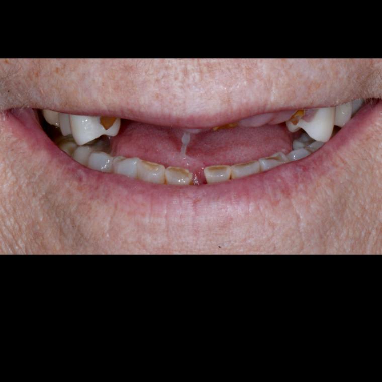 Case photo