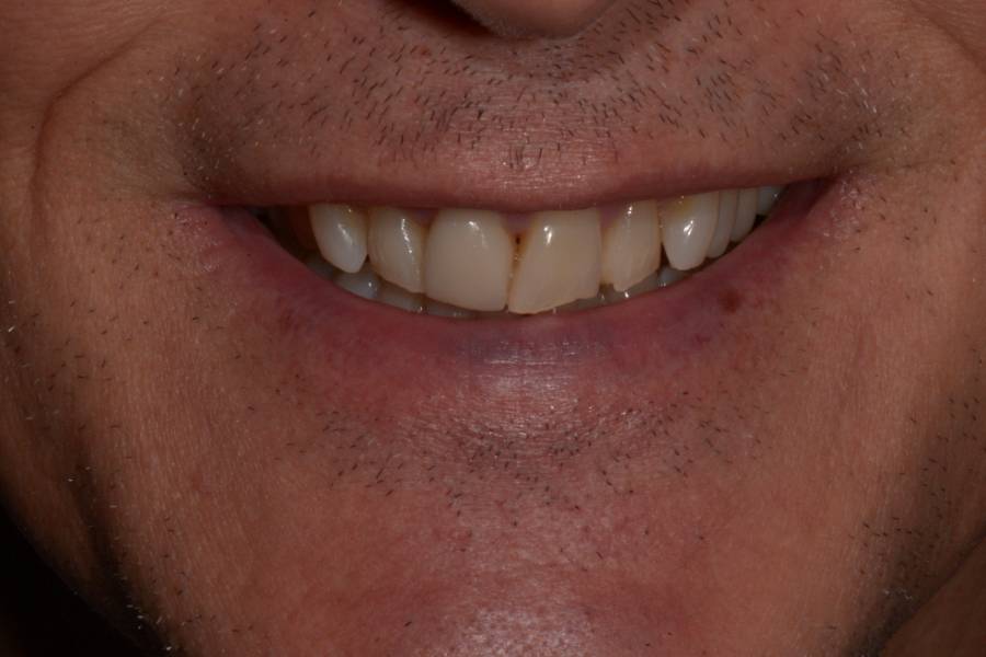 Case photo
