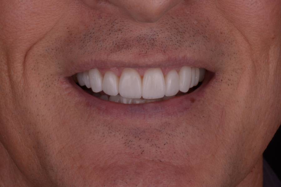 Case photo